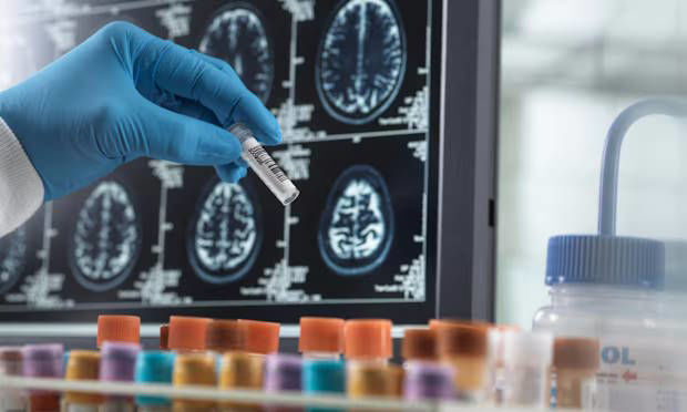 Picture of Early blood test to predict dementia is step closer as biological markers identified