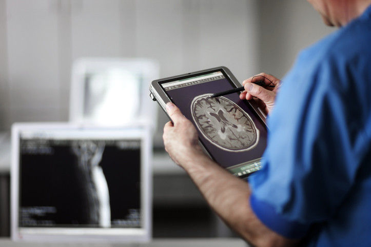 Picture of A balanced approach to eating may be best for brain health