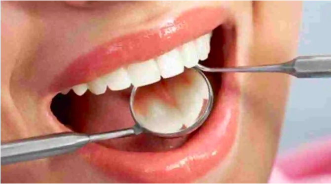 Picture of Should you drink water before or after brushing your teeth? Read on to find out