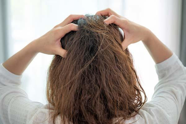 Picture of What could be causing your itchy scalp?